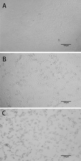 In Vitro Inactivation Of Sars Cov 2 By Commonly Used Disinfection Products And Methods Scientific Reports