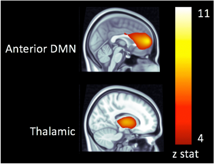 Early protein intake predicts functional connectivity and neurocognition in preterm born children