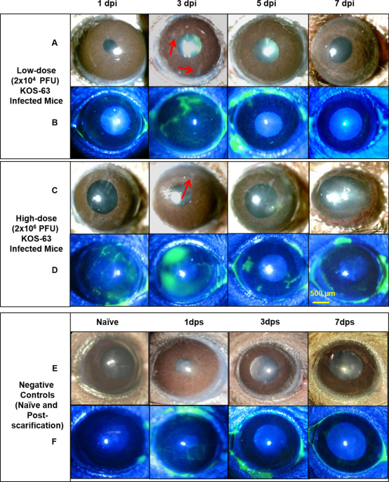 Herpes Simplex Virus 1 Kos 63 Strain Is Virulent And Causes Titer Dependent Corneal Nerve Damage And Keratitis Scientific Reports