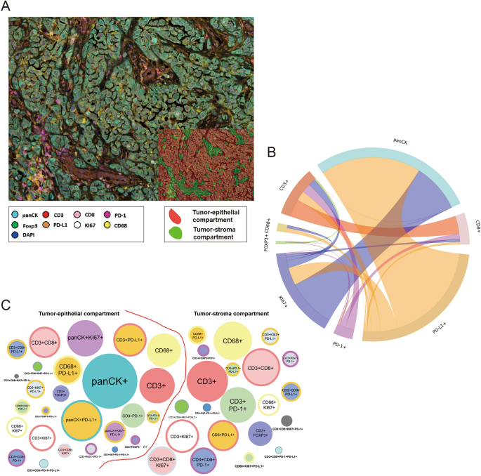 Identification of distinct immune landscapes using an automated nine-color  multiplex immunofluorescence staining panel and image analysis in paraffin  tumor tissues | Scientific Reports