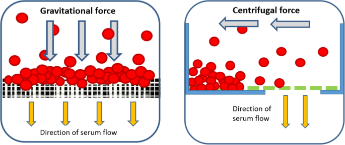 A centrifugal microfluidic cross-flow filtration platform to separate serum  from whole blood for the detection of amphiphilic biomarkers | Scientific  Reports