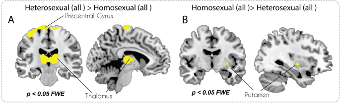 Brain structure changes associated with sexual orientation Scientific Reports picture