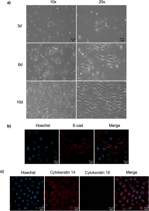 Increased cell membrane permeability of HeLa cells after C. trachomatis