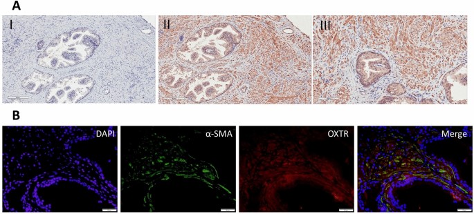 Oxytocin Receptor Antagonists As A Novel Pharmacological Agent For Reducing Smooth Muscle Tone In The Human Prostate Scientific Reports