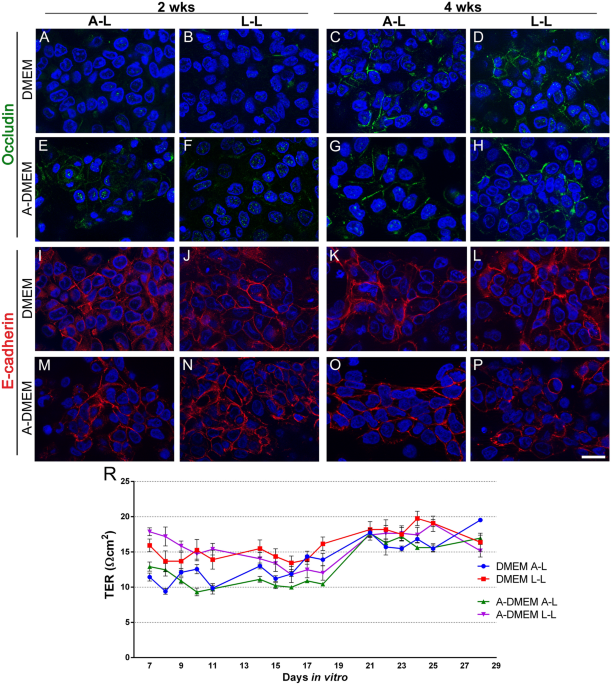 The Low/High BCS Permeability Class Boundary: Physicochemical Comparison of  Metoprolol and Labetalol