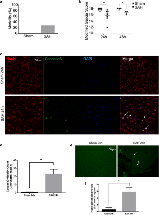 Gene expression profiling of brain endothelial cells after 
