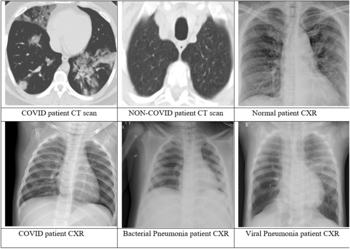 Graphcovidnet A Graph Neural Network Based Model For Detecting Covid 19 From Ct Scans And X Rays Of Chest Scientific Reports