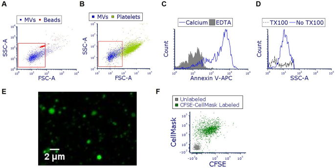 Microvesicles Released From Pneumolysin Stimulated Lung Epithelial Cells Carry Mitochondrial Cargo And Suppress Neutrophil Oxidative Burst Scientific Reports