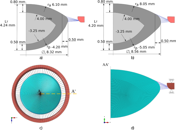 A numerical investigation of changes in lens shape during accommodation |  Scientific Reports