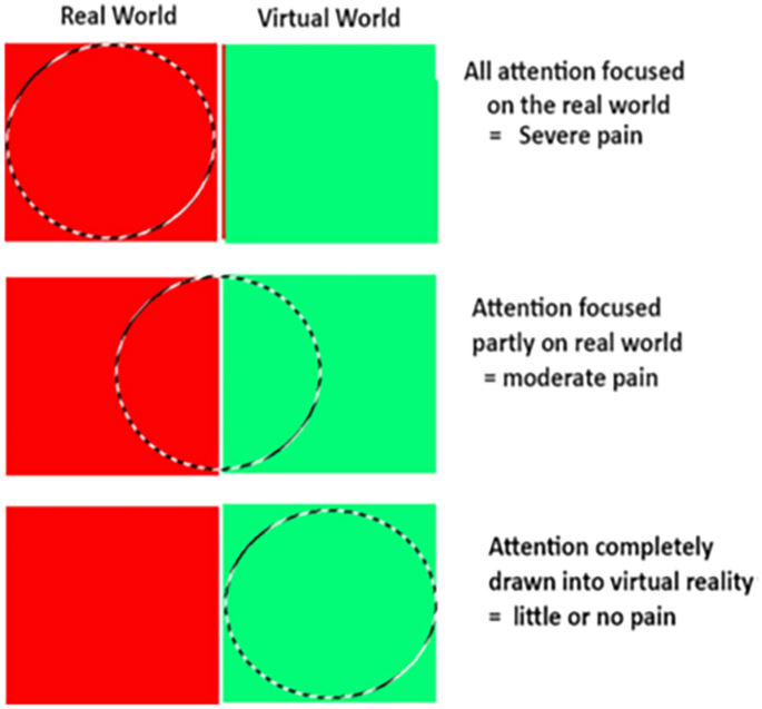 I navnet Shuraba vinge Interacting with virtual objects via embodied avatar hands reduces pain  intensity and diverts attention | Scientific Reports