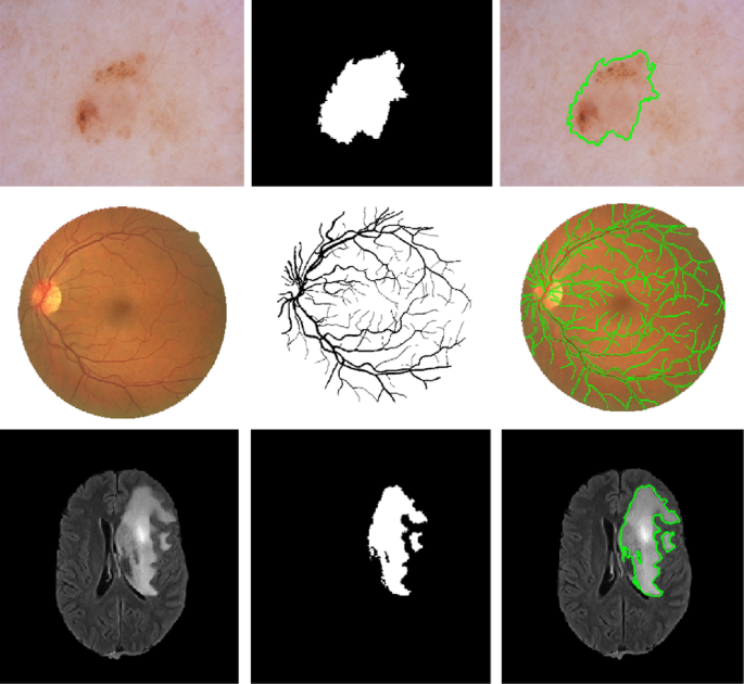 Cmm Net Contextual Multi Scale Multi Level Network For Efficient Biomedical Image Segmentation Scientific Reports