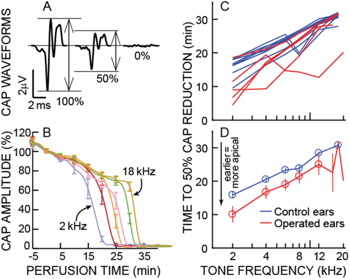 PDF] Investigating the effect of extended high-frequency hearing