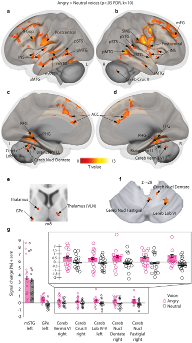 Basal ganglia and cerebellum contributions to vocal emotion processing as revealed by high-resolution fmri
