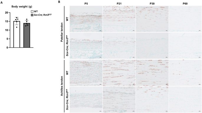Reticulocalbin 3 Is Involved In Postnatal Tendon Development By Regulating Collagen Fibrillogenesis And Cellular Maturation Scientific Reports