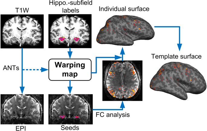 Brainwide Functional Networks Associated With Anatomically And Functionally Defined Hippocampal Subfields Using Ultrahigh Resolution Fmri Scientific Reports Brainwide Functional Networks Associated With Anatomically And Functionally Defined Hippocampal Subfields Using Ultrahigh Resolution Fmri Scientific Reports