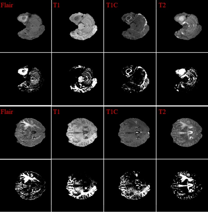 PDF] Brain Tumor Segmentation of MRI Images Using Processed Image Driven  U-Net Architecture