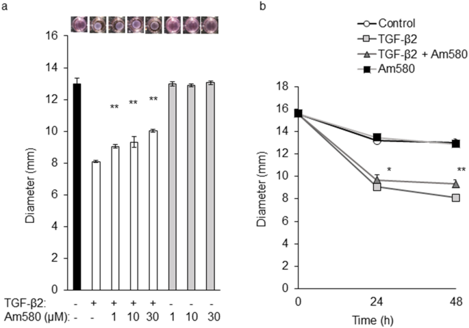 Inhibition Of Epithelial Mesenchymal Transition In Retinal Pigment Epithelial Cells By A Retinoic Acid Receptor A Agonist Scientific Reports