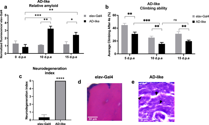 Kefir metabolites in a fly model for Alzheimer's disease