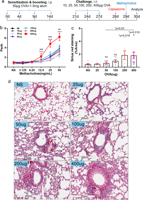An Initial Assessment Of The Involvement Of Transglutaminase2 In Eosinophilic Bronchitis Using A Disease Model Developed In C57bl 6 Mice Scientific Reports An Initial Assessment Of The Involvement Of Transglutaminase2 In Eosinophilic Bronchitis Using A Disease Model Developed In C57bl 6 Mice Scientific Reports