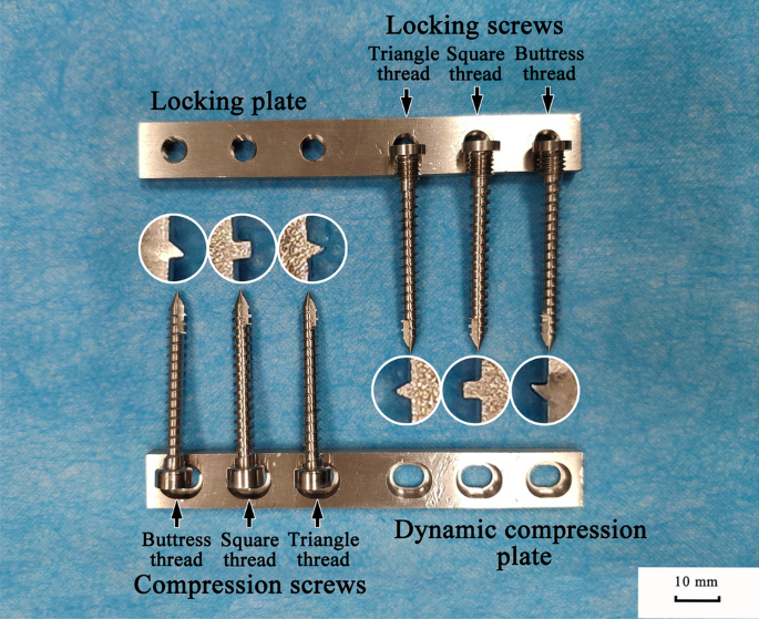 Lateral migration resistance of screw is essential in evaluating bone screw  stability of plate fixation | Scientific Reports