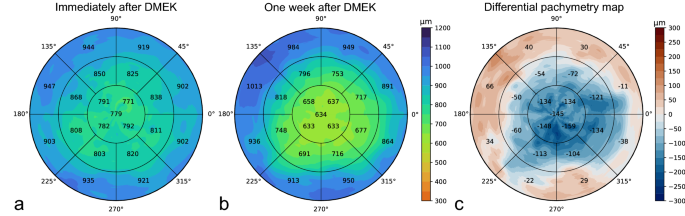 29+ Corneal Pachymetry Conversion Chart