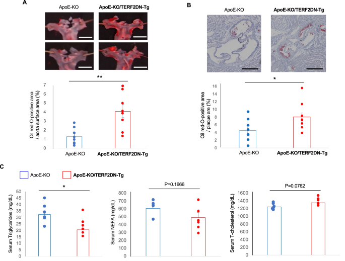 Cellular Senescence Promotes Endothelial Activation Through Epigenetic Alteration And Consequently Accelerates Atherosclerosis Scientific Reports