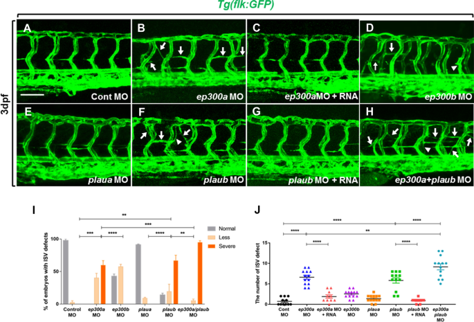 Identification of de novo EP300 and PLAU variants in a patient