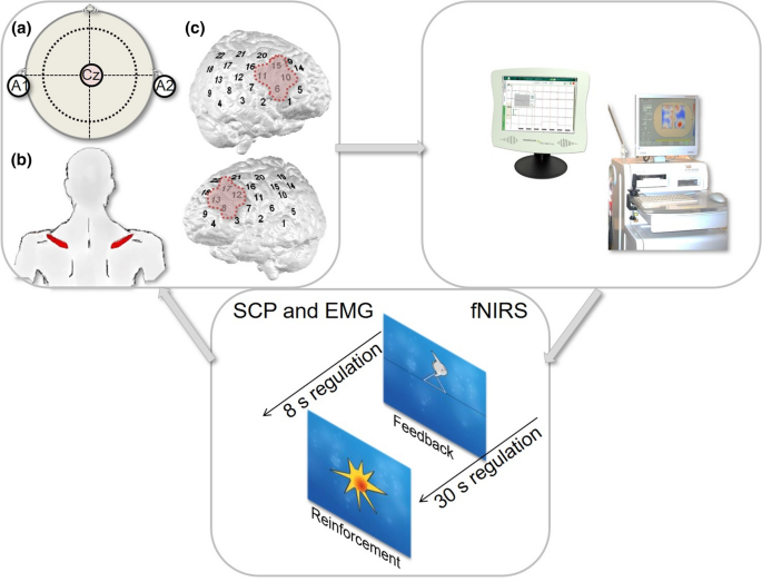 PDF) Evidence-Based Information on the Clinical Use of Neurofeedback for  ADHD