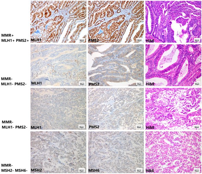 Ck7+ ck20+ tumors