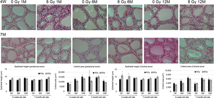 Age-dependent effects on radiation-induced carcinogenesis in the rat thyroid
