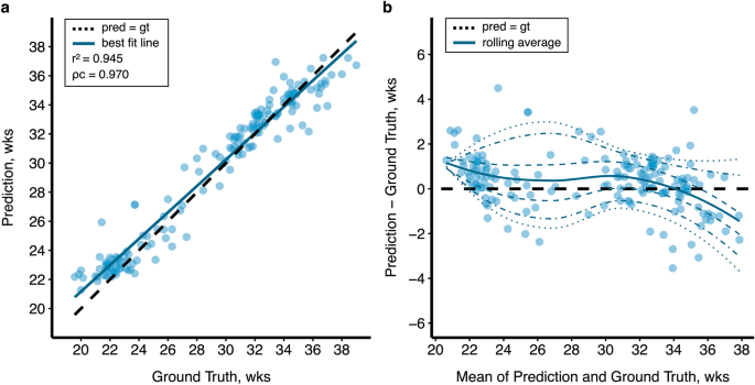 Attention-guided deep learning for gestational age prediction 