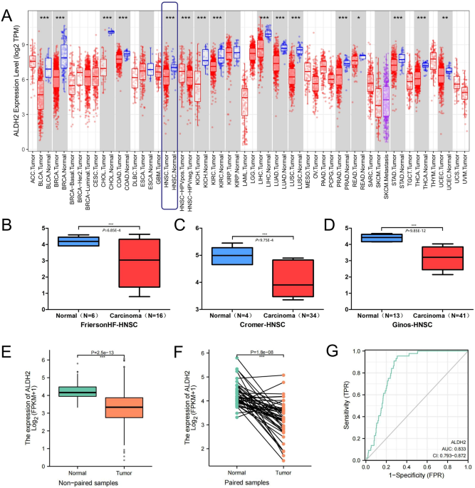 Exploring ALDH2 expression and immune infiltration in HNSC and its correlation of prognosis with gender or alcohol intake