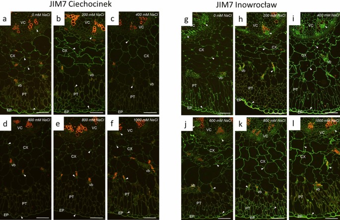 Maternal salinity influences anatomical parameters, pectin content