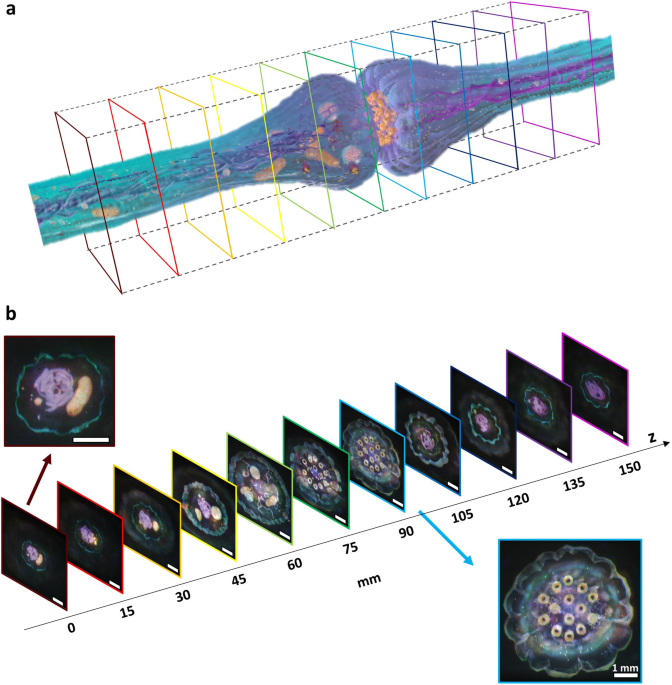 High-contrast, speckle-free, true 3D holography via binary CGH optimization