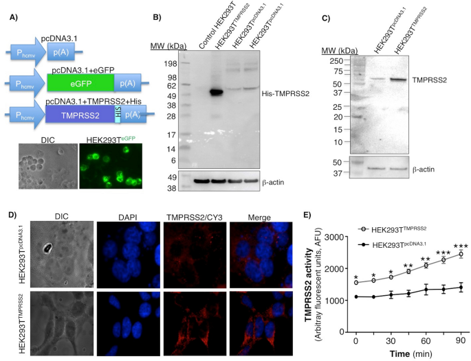 Alpha 1 Antitrypsin is an Inhibitor of the SARS-CoV-2–Priming