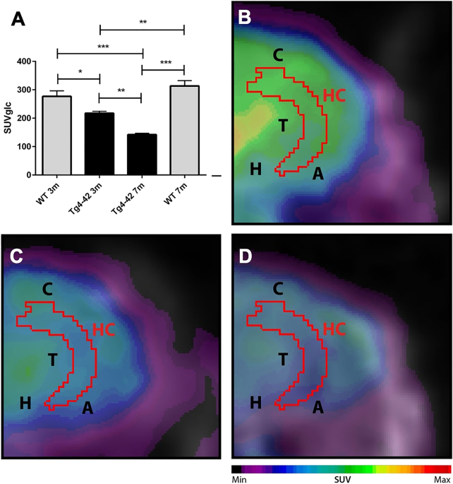 Search strategy analysis of Tg4-42 Alzheimer Mice in the Morris