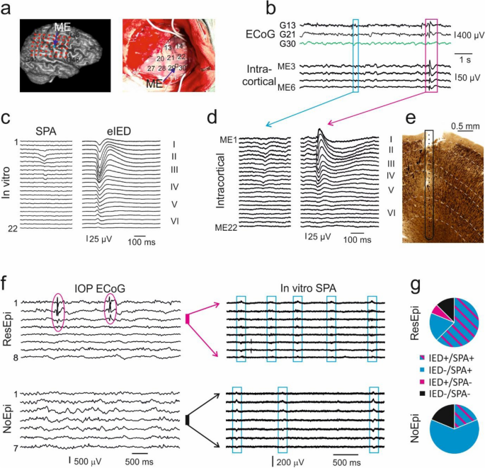 PDF) Epilepsy and the Laboratory Technician: Technique in Histology and  Fiction