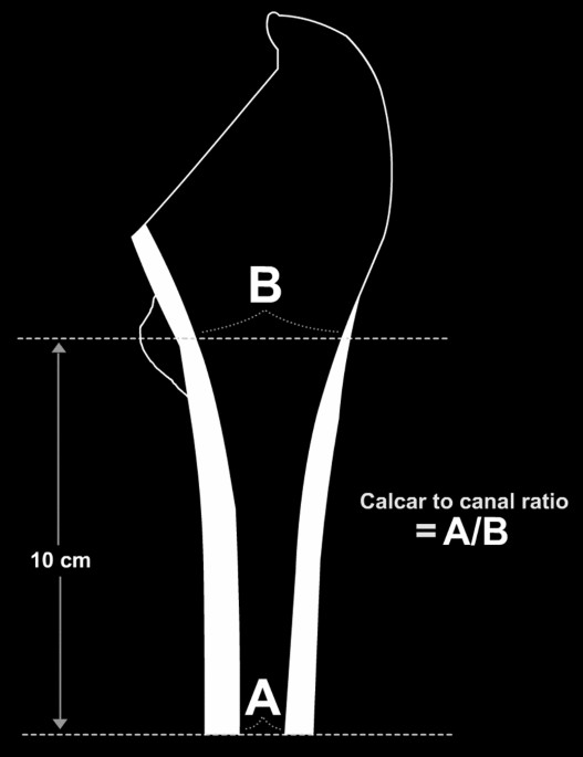 A comparison between Austin-Moore and Corail prosthesis regarding intraoperative periprosthetic femu