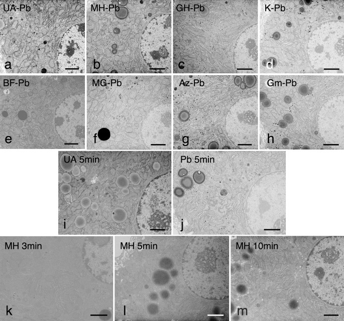 Novel electron microscopic staining method using traditional dye, hematoxylin | Scientific Reports