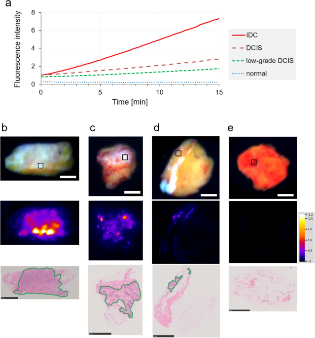 Breast cancer evaluation by fluorescent dot detection using combined  mathematical morphology and multifractal techniques, Diagnostic Pathology