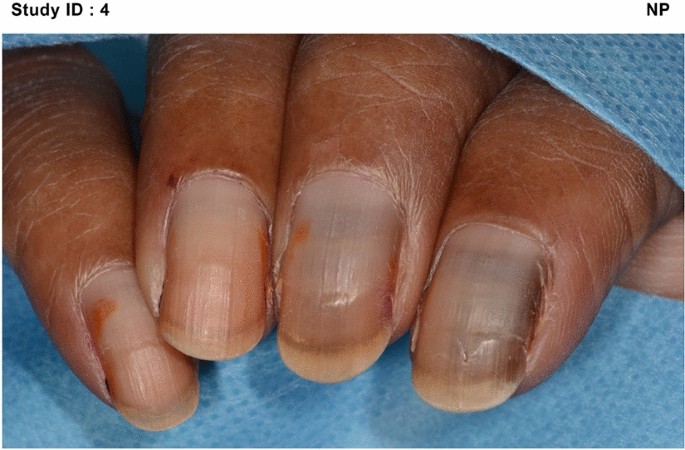 Nail Reading, Study of Nails | Palm reading, Palmistry, Palmistry reading