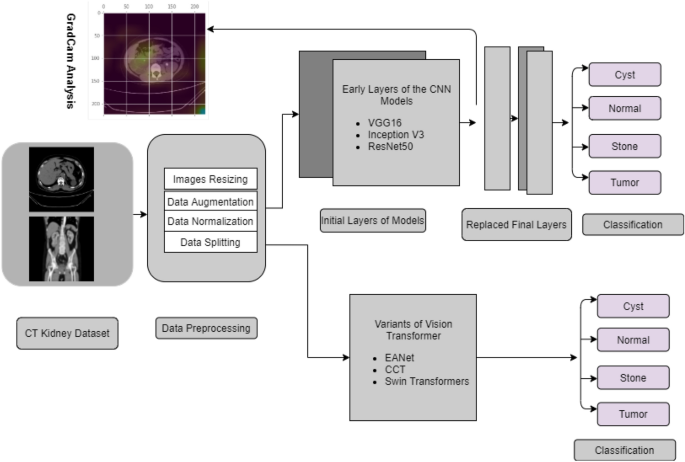 Vision transformer and explainable transfer learning models for auto detection of kidney cyst, stone and tumor from ct-radiography