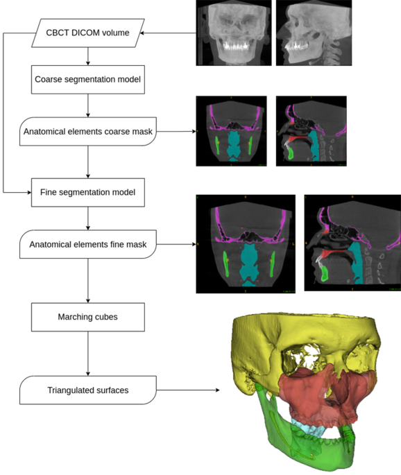 AI-based automatic segmentation of craniomaxillofacial anatomy from CBCT scans for automatic detecti