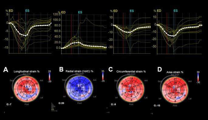 Strain Echocardiography in Acute Cardiovascular Diseases - The