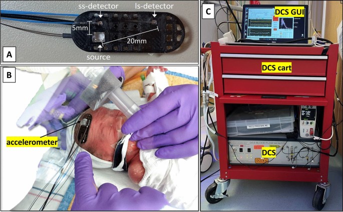 bloodwork monitoring for cjc-1295 ipamorelin igf-1 lr3 enclomiphene cycle Diffuse correlation spectroscopy blood flow monitoring for intraventricular  hemorrhage vulnerability in extremely low gestational age newborns
