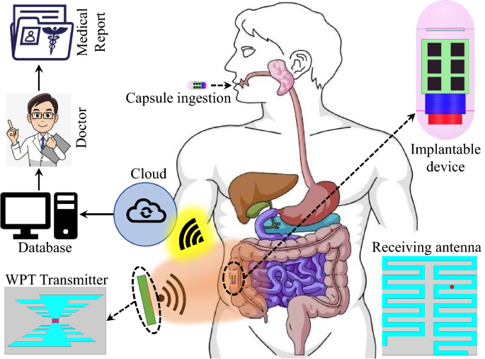 Wireless power transfer system for deep-implanted biomedical devices |  Scientific Reports