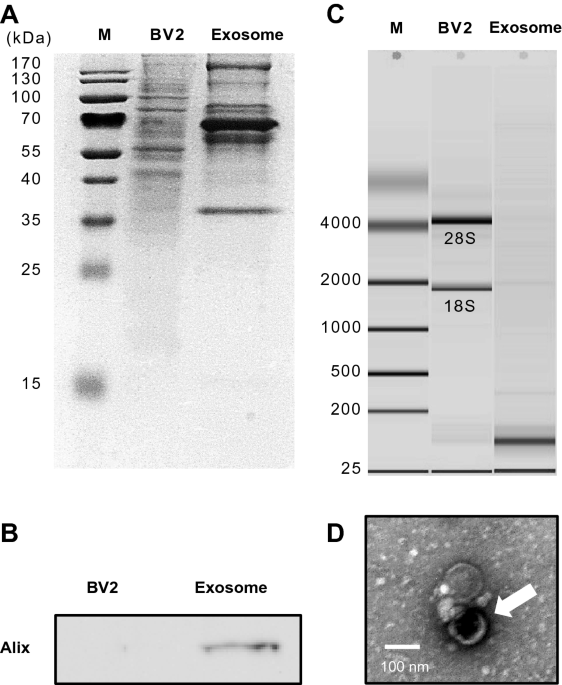 Exosomal miRNA-21 from Toxoplasma gondii-infected microglial cells induces the growth of U87 glioma cells by inhibiting tumor suppressor genes | Scientific Reports