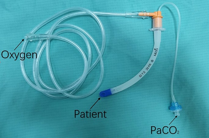 nasal oxygen catheter