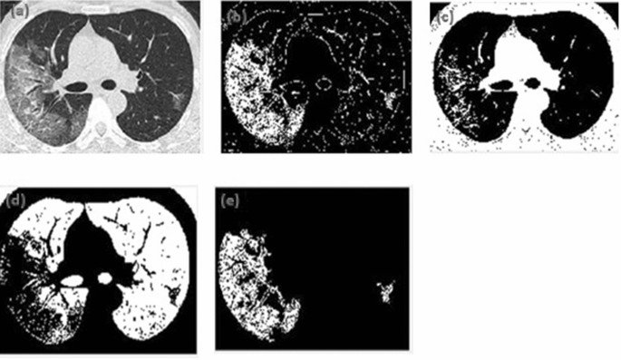 Automated system for classification of COVID-19 infection from lung CT  images based on machine learning and deep learning techniques | Scientific  Reports