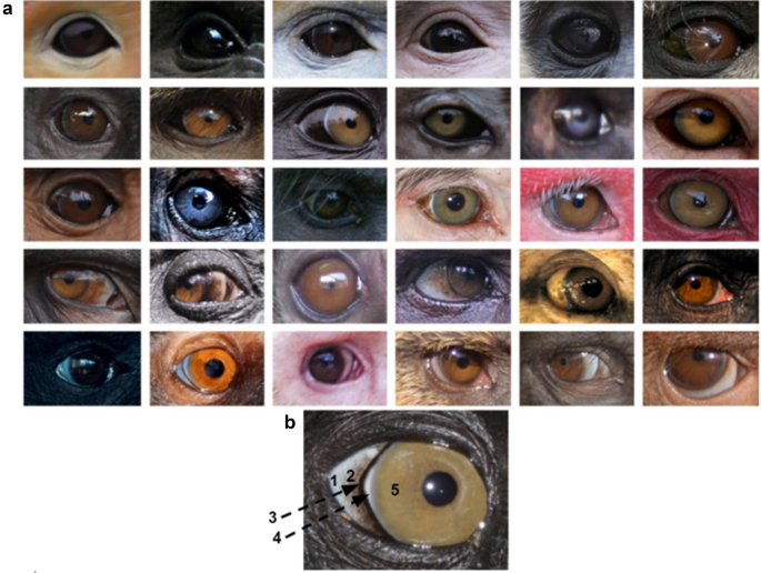 What colour are your eyes? Teaching the genetics of eye colour & colour  vision. Edridge Green Lecture RCOphth Annual Congress Glasgow May 2019